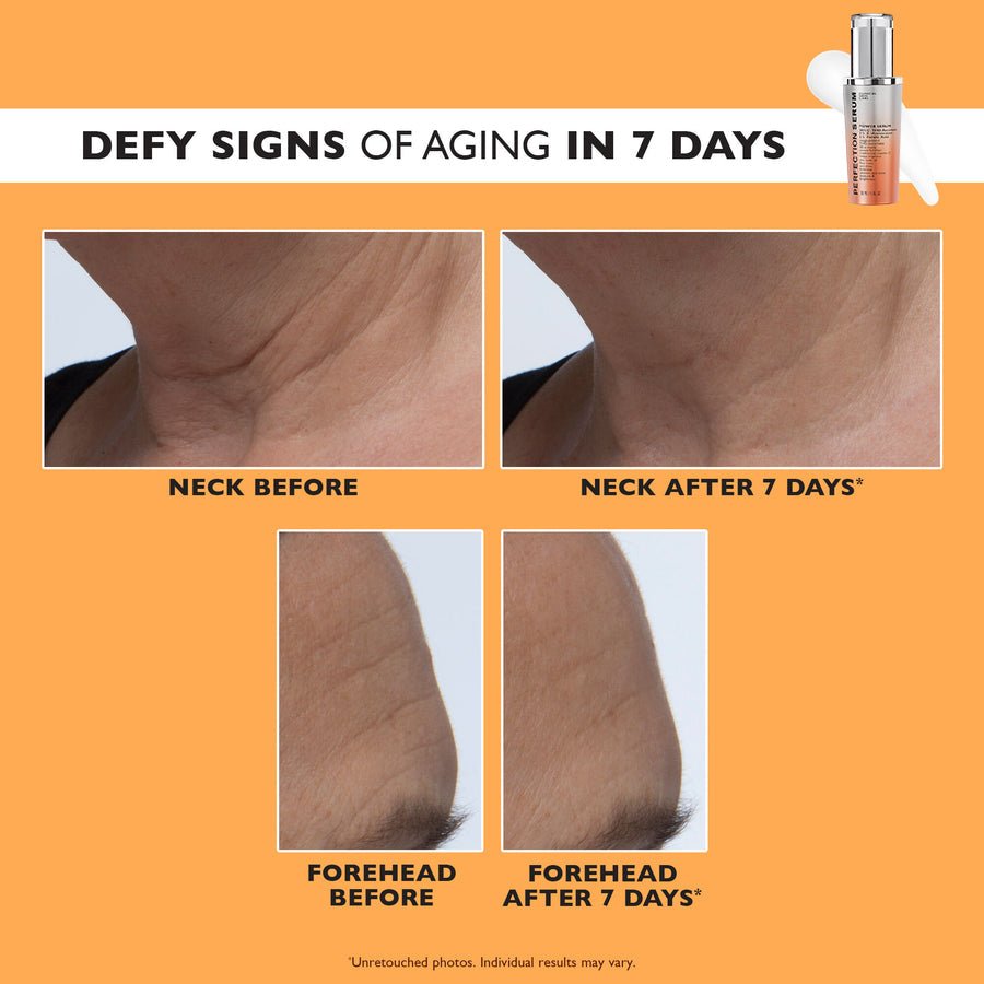 🔥 Last Day Discount: 50% OFF 🍊Power-C Serum