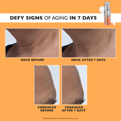 🔥 Last Day Discount: 50% OFF 🍊Power-C Serum